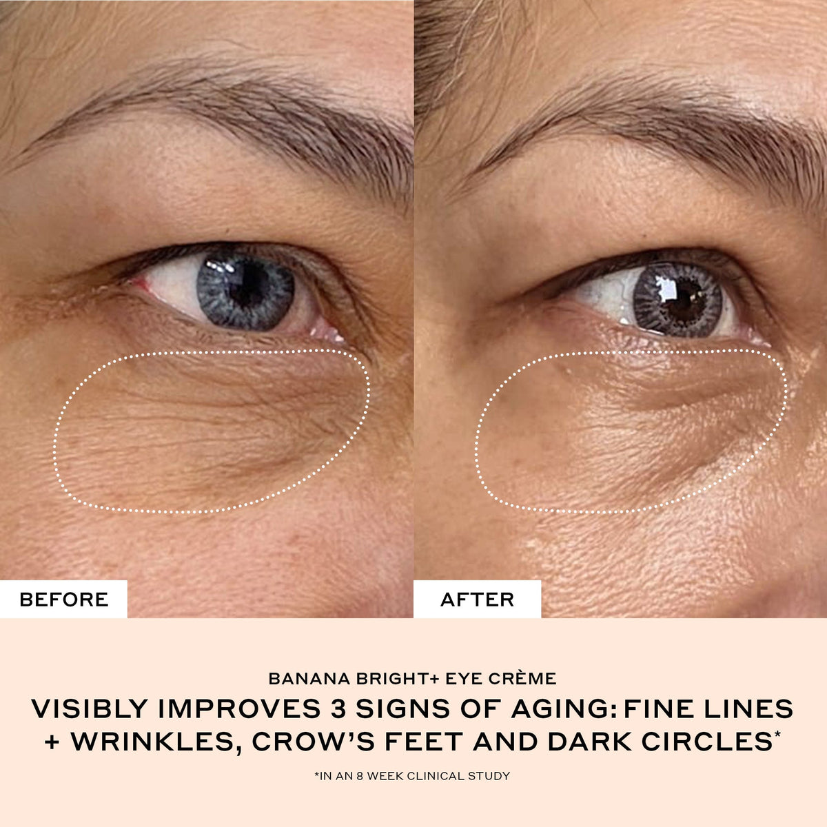Banana Bright+ Vitamin C Eye Crème for Dark Circles Your Skincare Option on a Quiet Morning