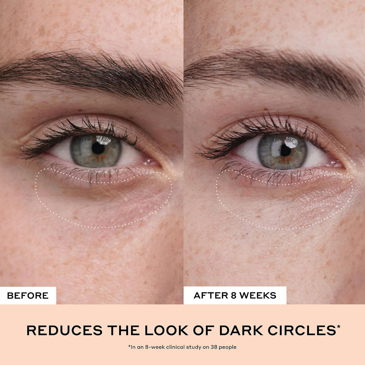 Clinical Quick Fix Mini Vitamin C + Peptide Duo Your Beauty Choice at Home