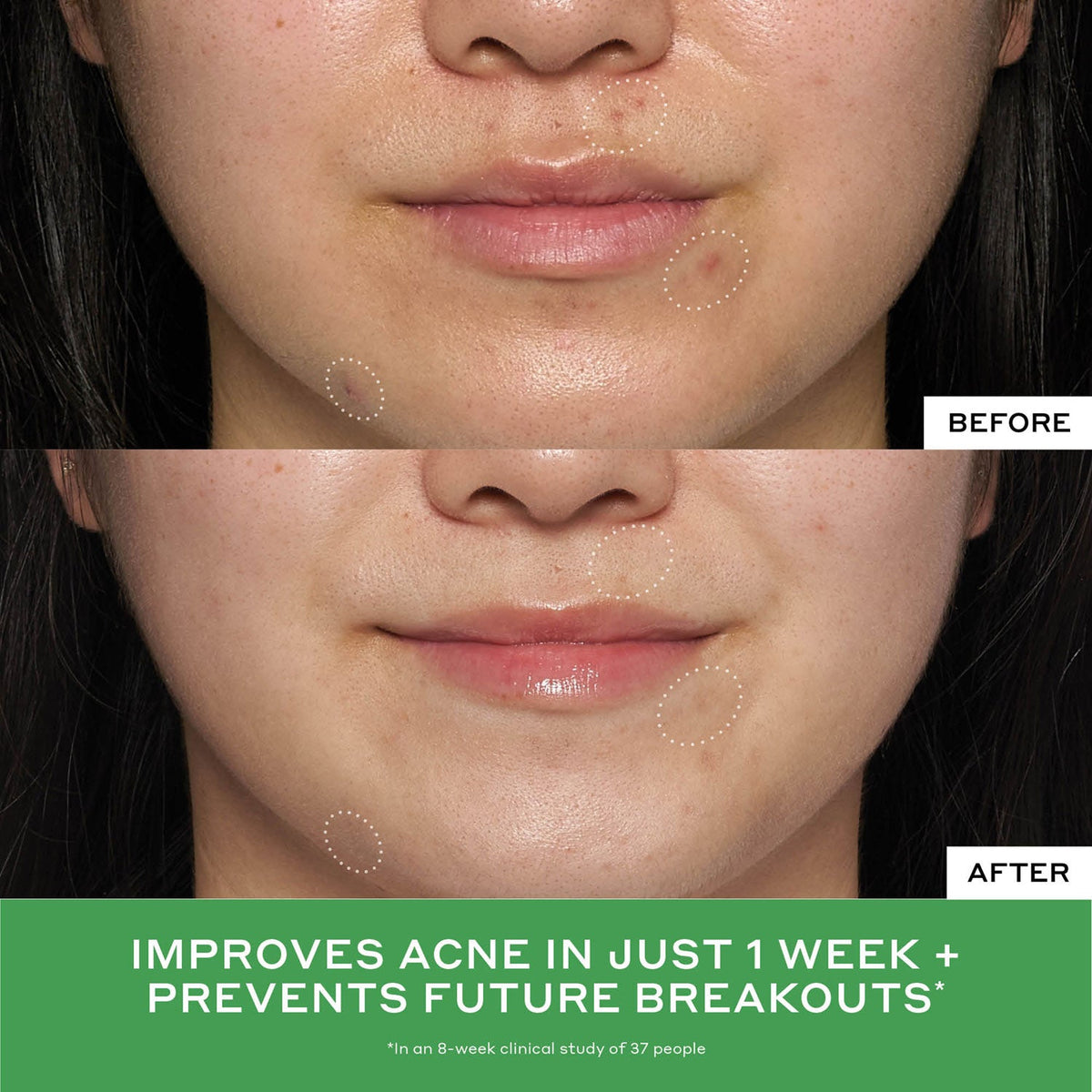 Detox Drops 2% Salicylic Acid Toner Your Beauty Choice for the Workday