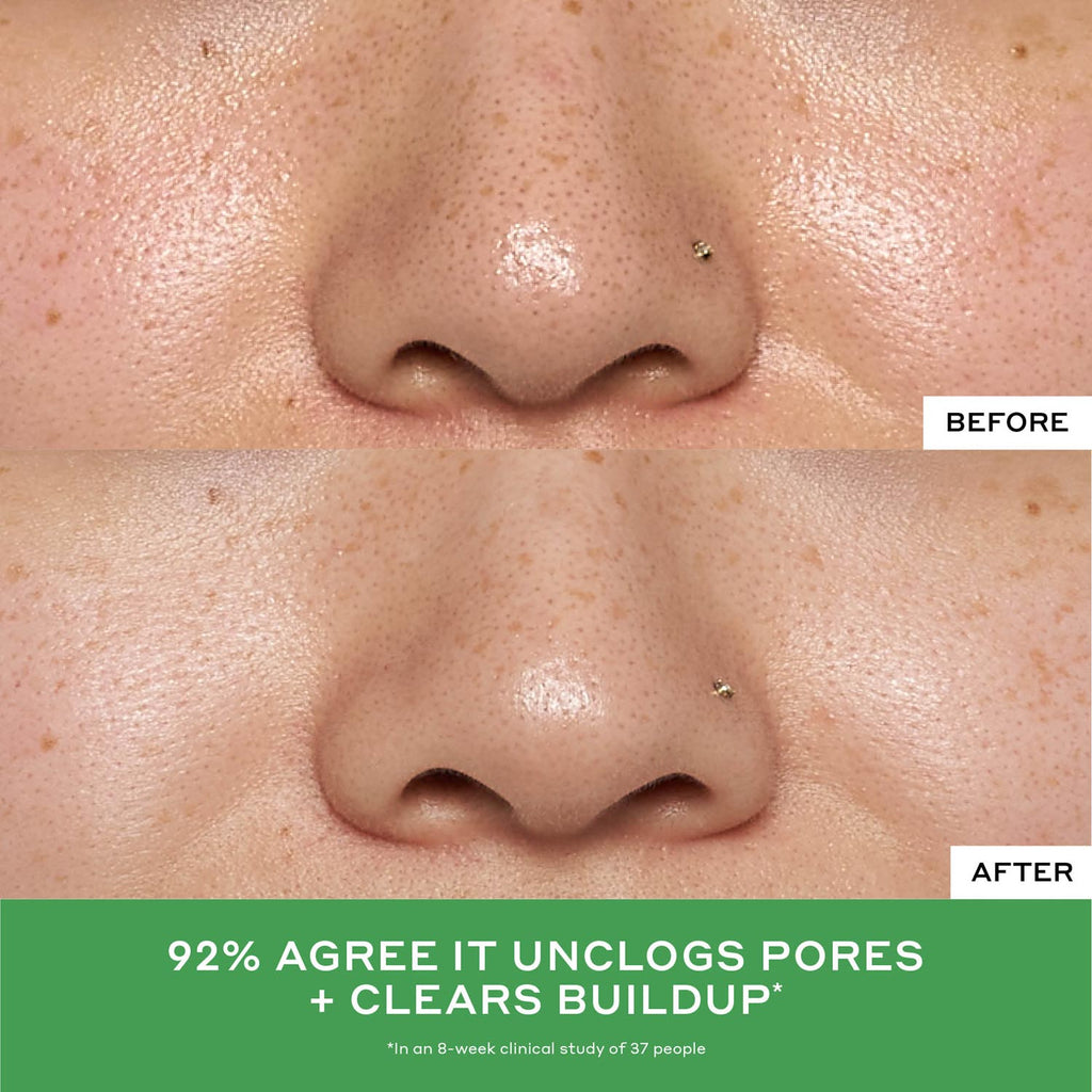 Detox Drops 2% Salicylic Acid Toner Your Beauty Choice for the Workday