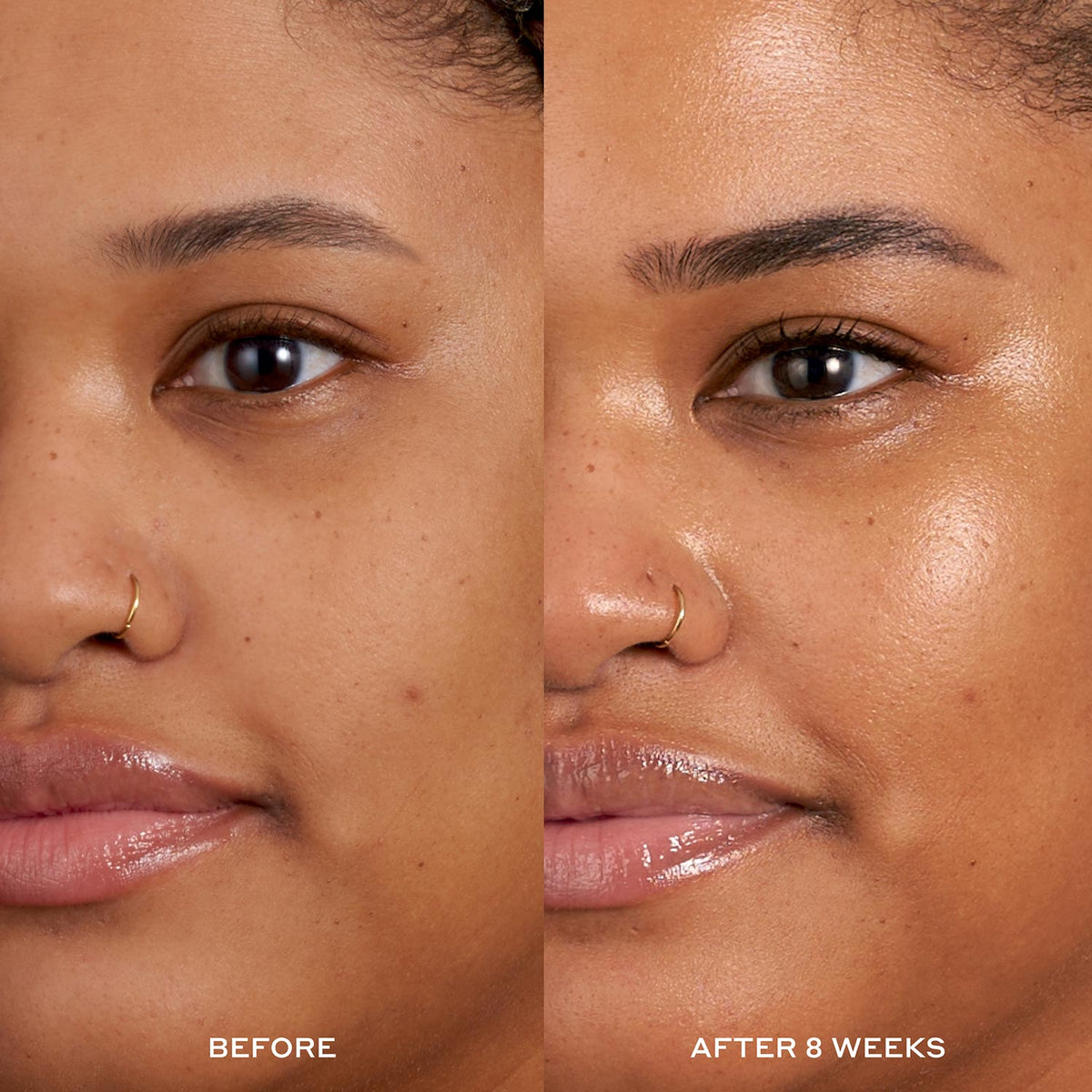Before and After image after 8 weeks of using Hydrabarrier Nourishing Face Oil. 