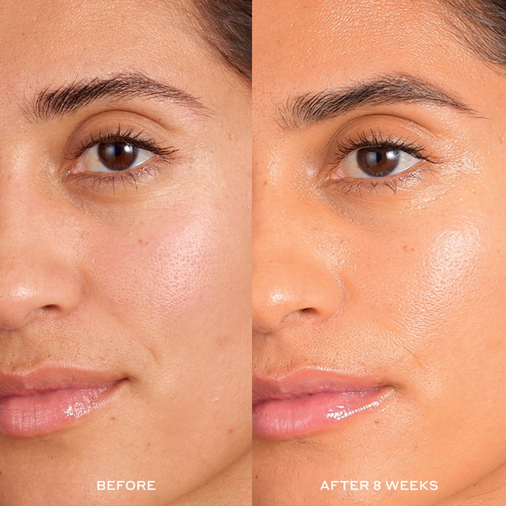Before and After image after 8 weeks of using Hydrabarrier Nourishing Face Oil. 
