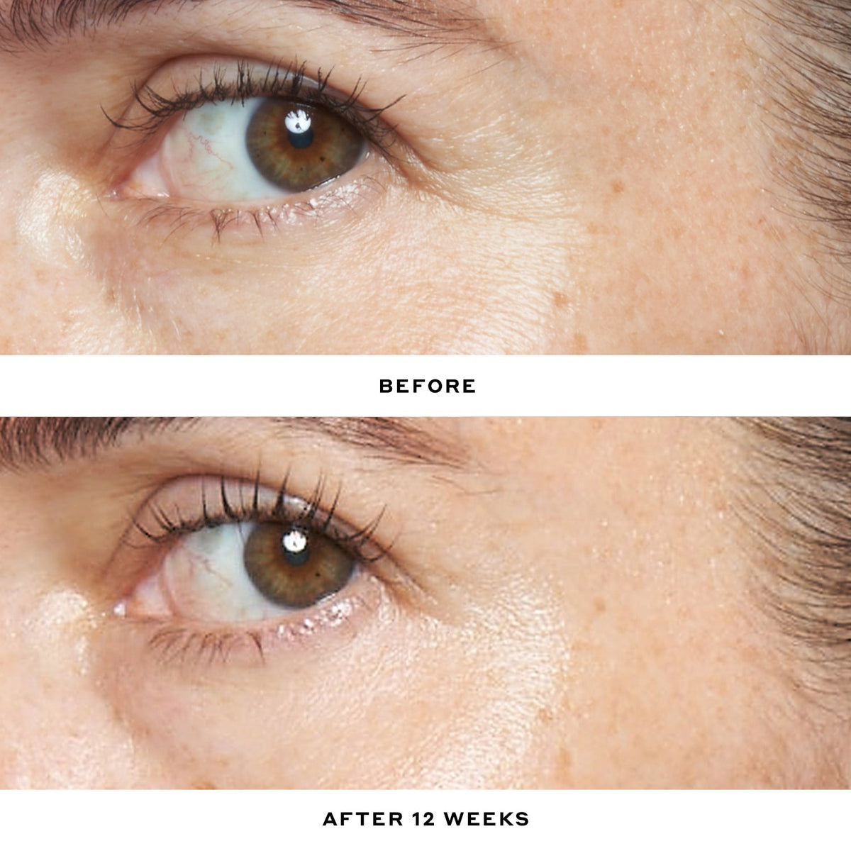 Double Rewind 0.3% Pro-Grade Retinol Serum Your Beauty Choice for Personal Time