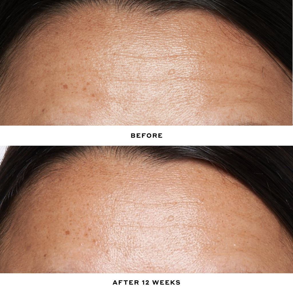 Double Rewind 0.3% Pro-Grade Retinol Serum Your Beauty Choice for Personal Time