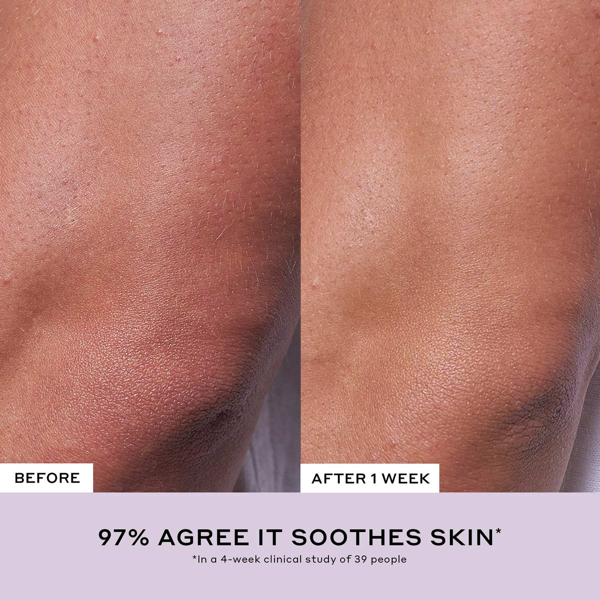 Après Skin Rich Rescue Barrier Moisturizer with Ceramides Your Beauty Pick in Your Bathroom