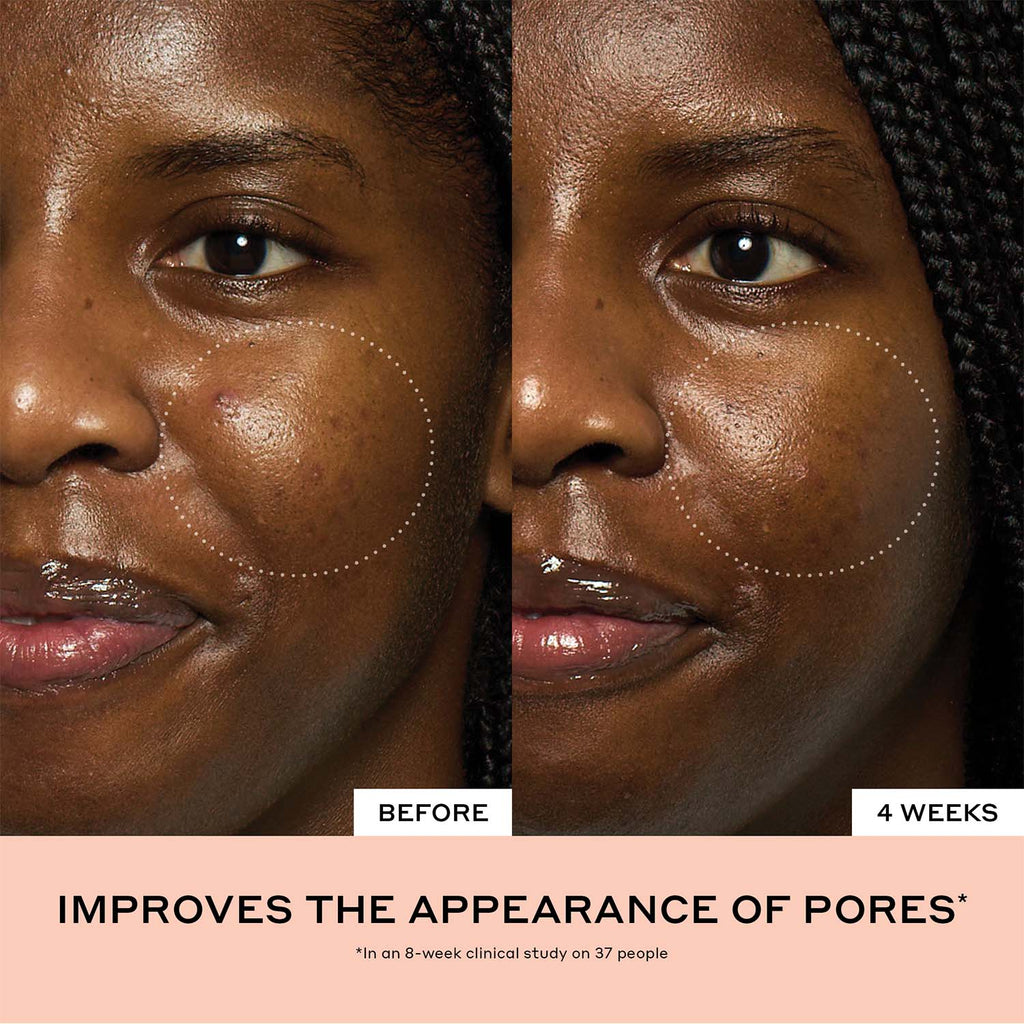 Peach Glaze Glow Niacinamide Serum with Vitamin C Your Routine Pick after a Long Day