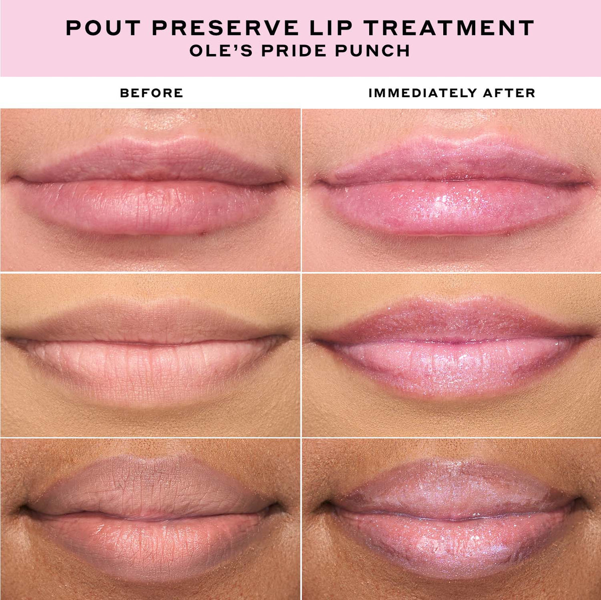 Pout Preserve Hydrating Peptide Lip Treatment Your Skincare Choice before Bed