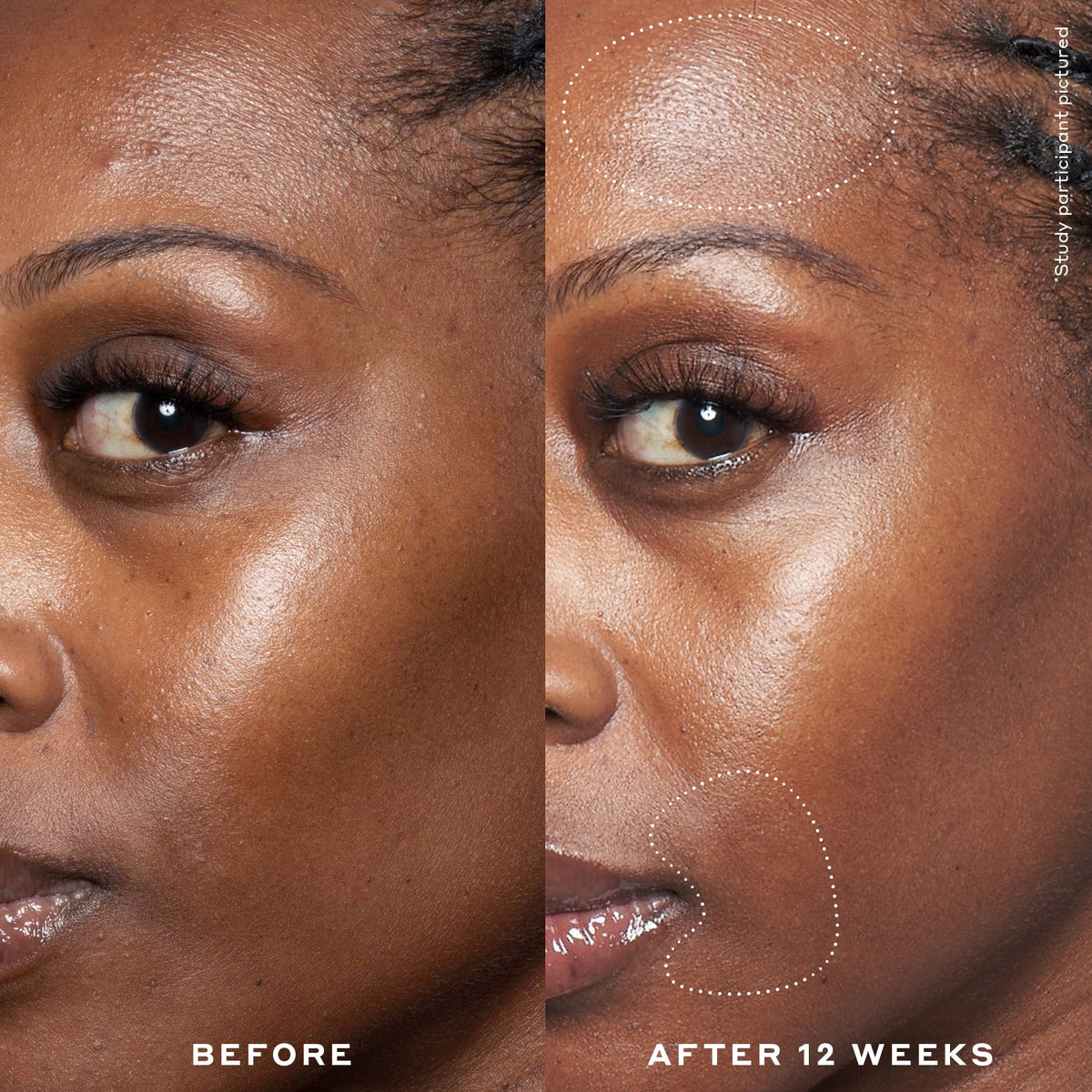 Double Rewind 0.3% Pro-Grade Retinol Serum Your Beauty Choice for Personal Time