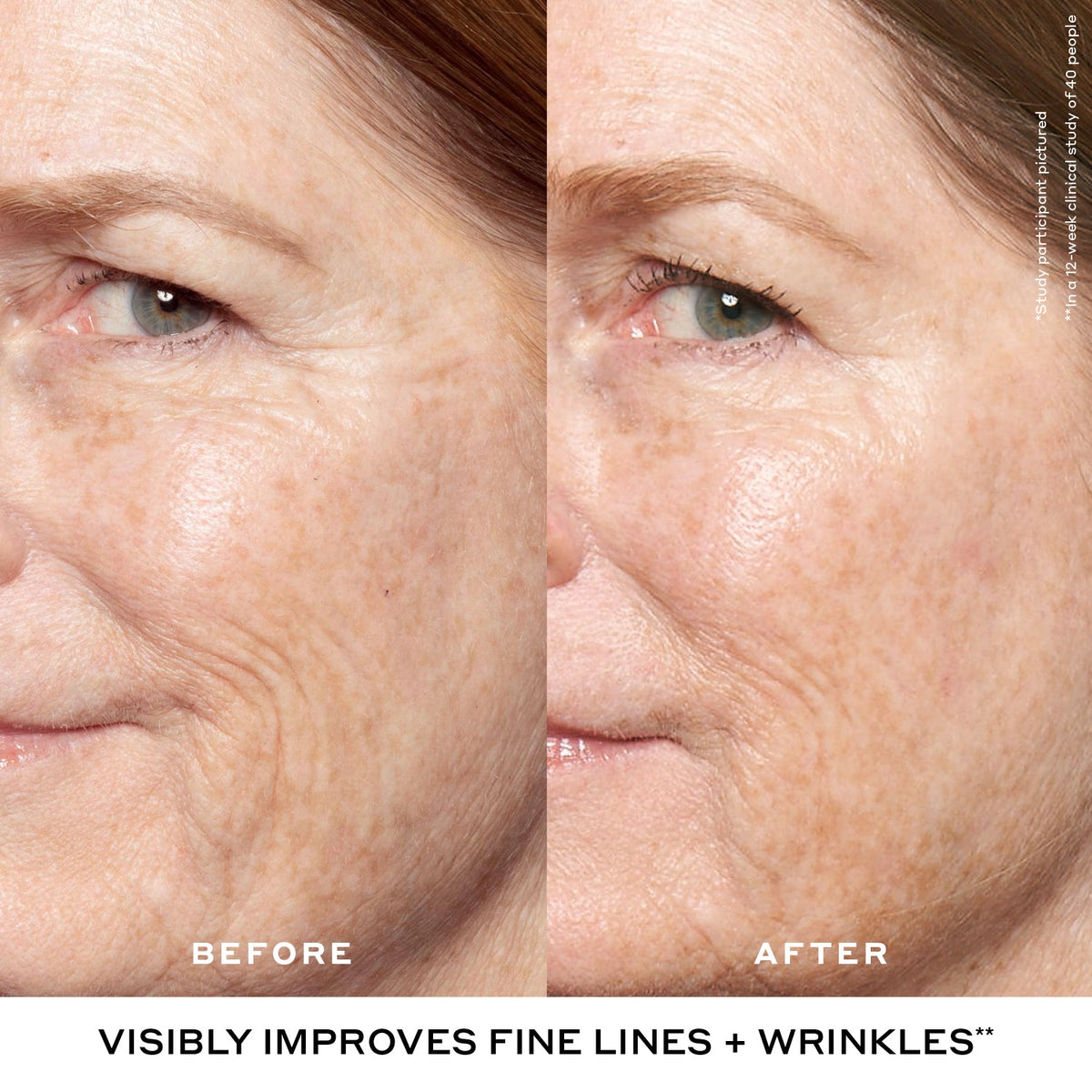 Double Rewind 0.3% Pro-Grade Retinol Serum Your Beauty Choice for Personal Time