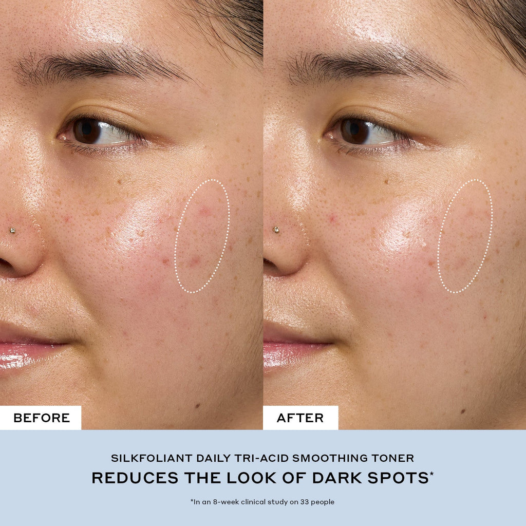 Silkfolaint Gentle Tri-Acid Exfoliating Toner for Dark Spots Your Care Essential for a Long Weekend