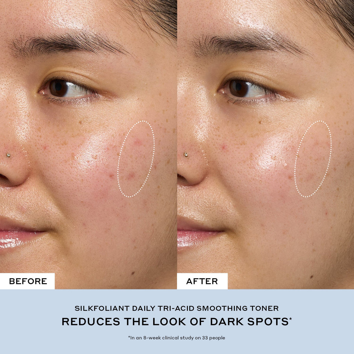 Silkfolaint Gentle Tri-Acid Exfoliating Toner for Dark Spots Your Care Essential for a Long Weekend