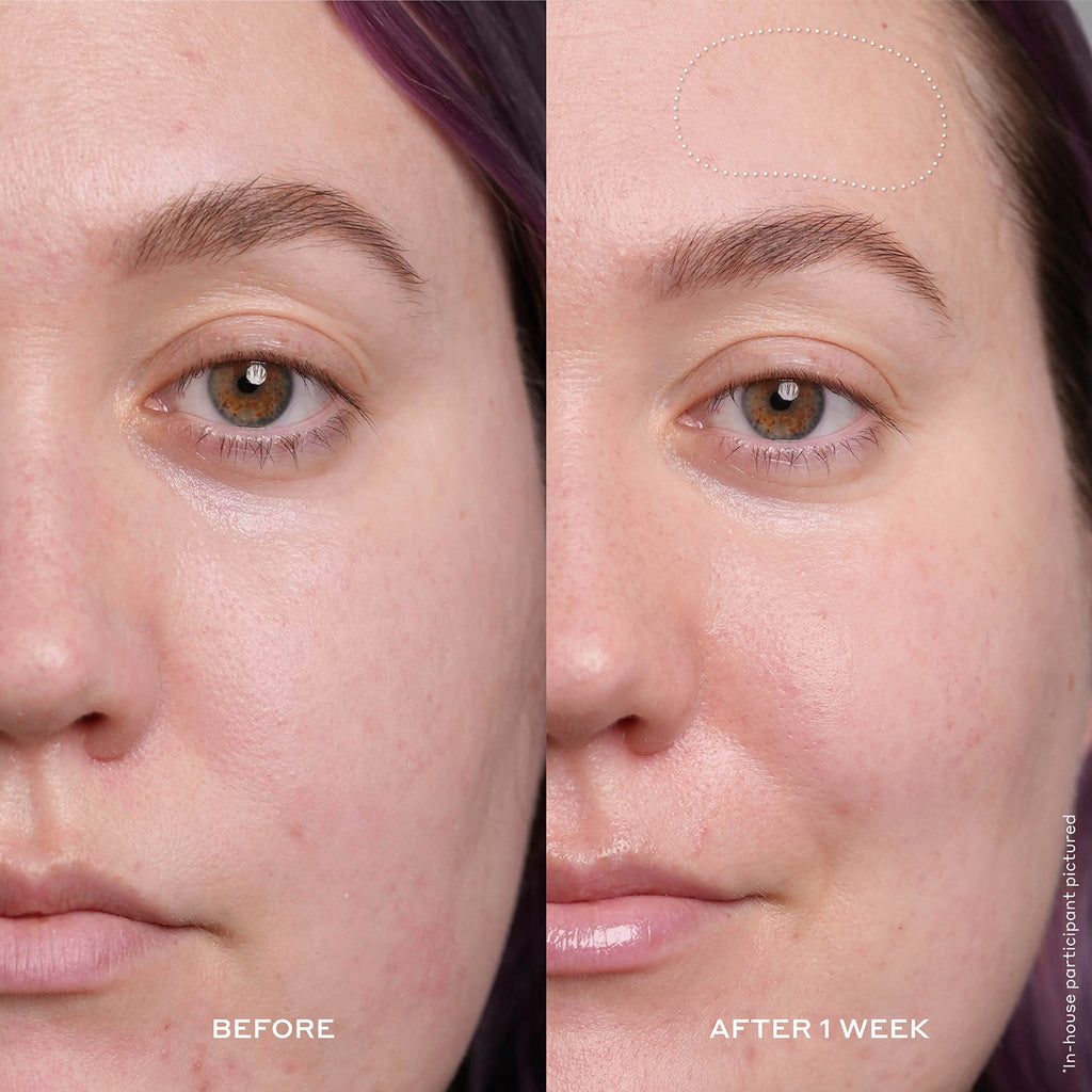 Before and After: Brighter, Bouncier Skin in 7 Days.* Improved Hydration and Elasticity.* Text on image with an asterisk that states Used product every day for one week
